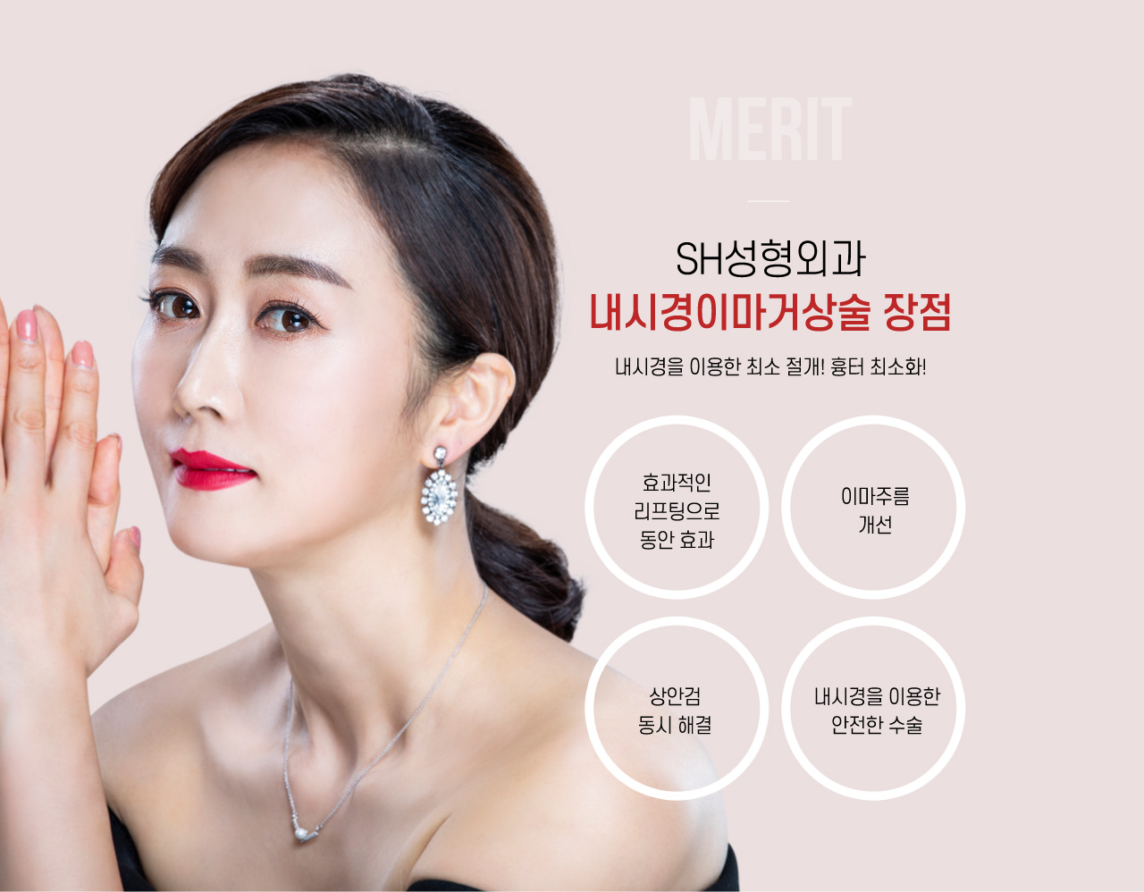 내시경이마거상술 장점