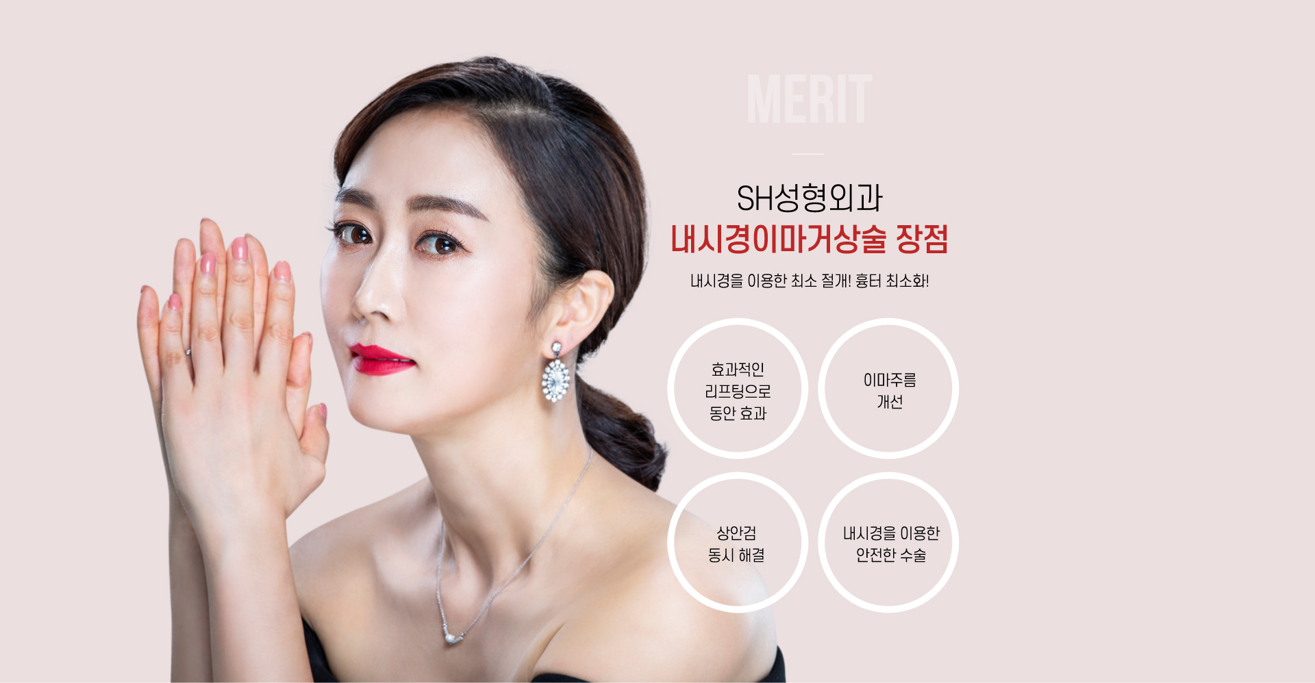 내시경이마거상술 장점