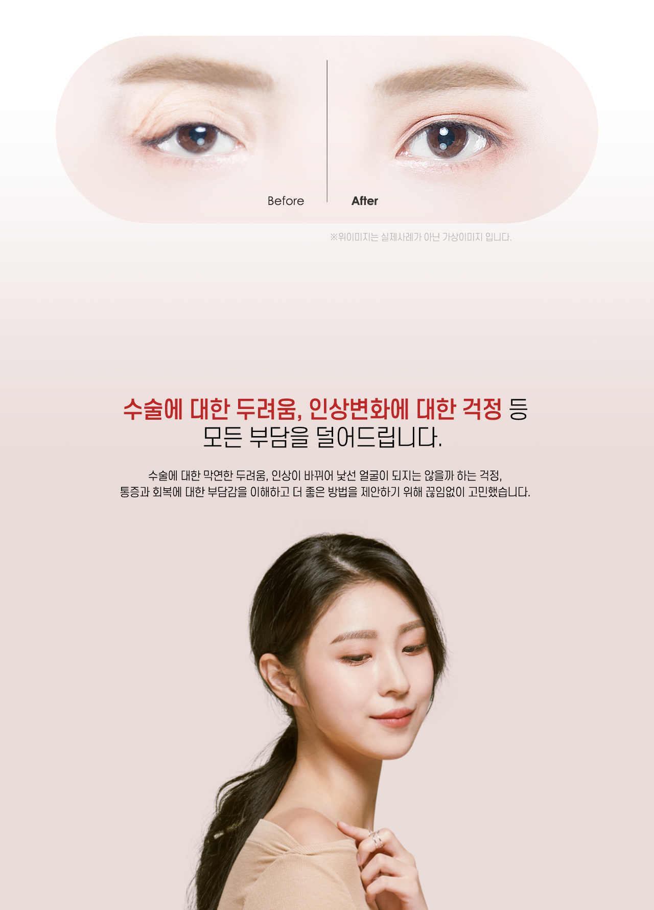 상안검