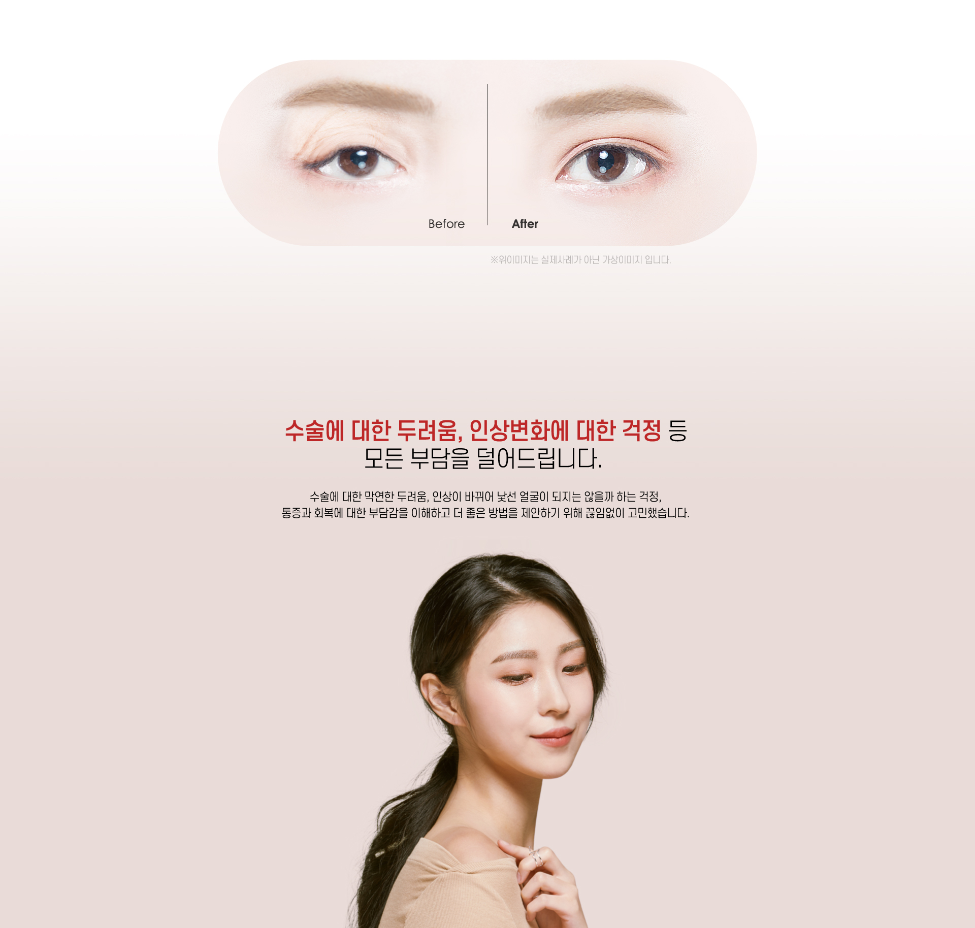 상안검