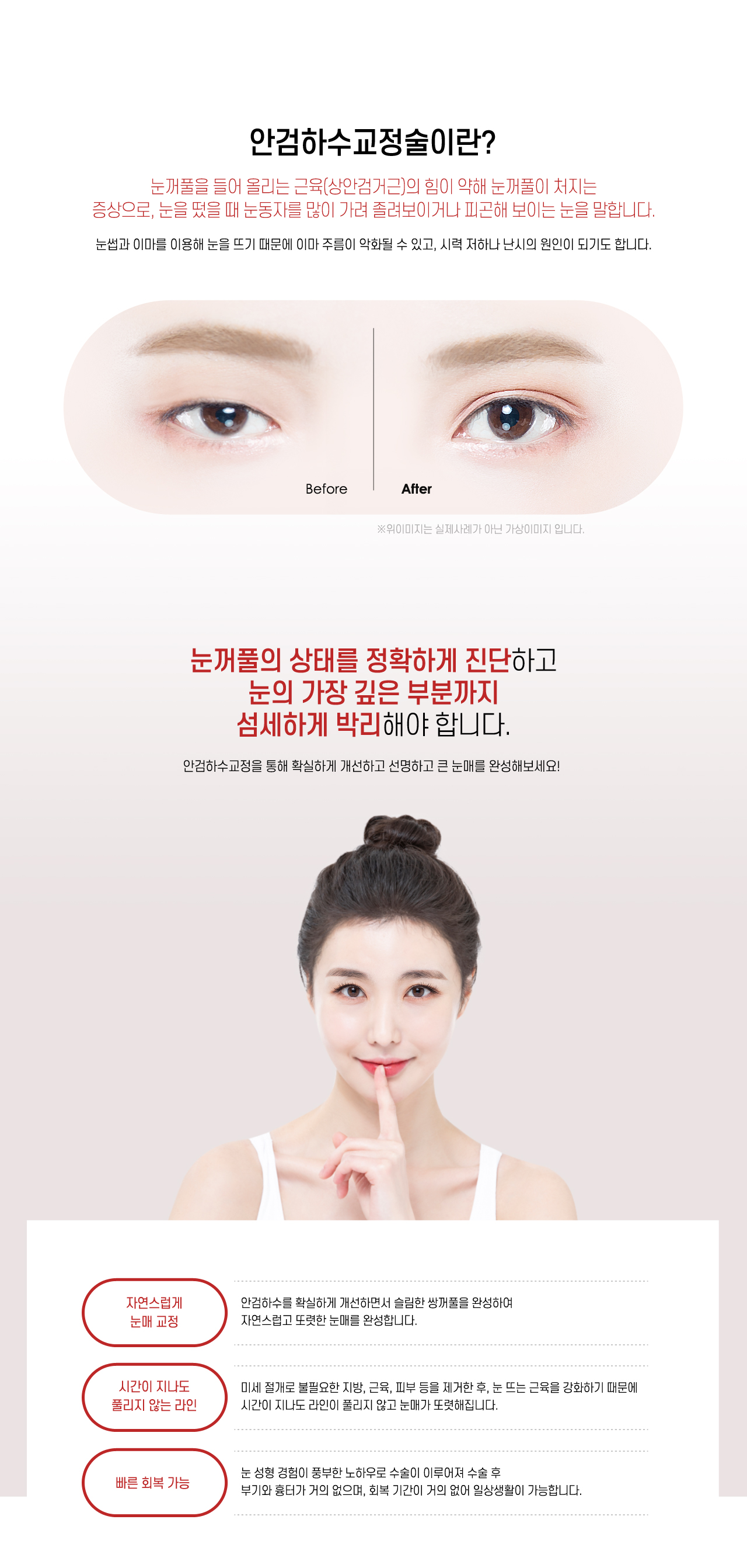 안검하수교정술이란?