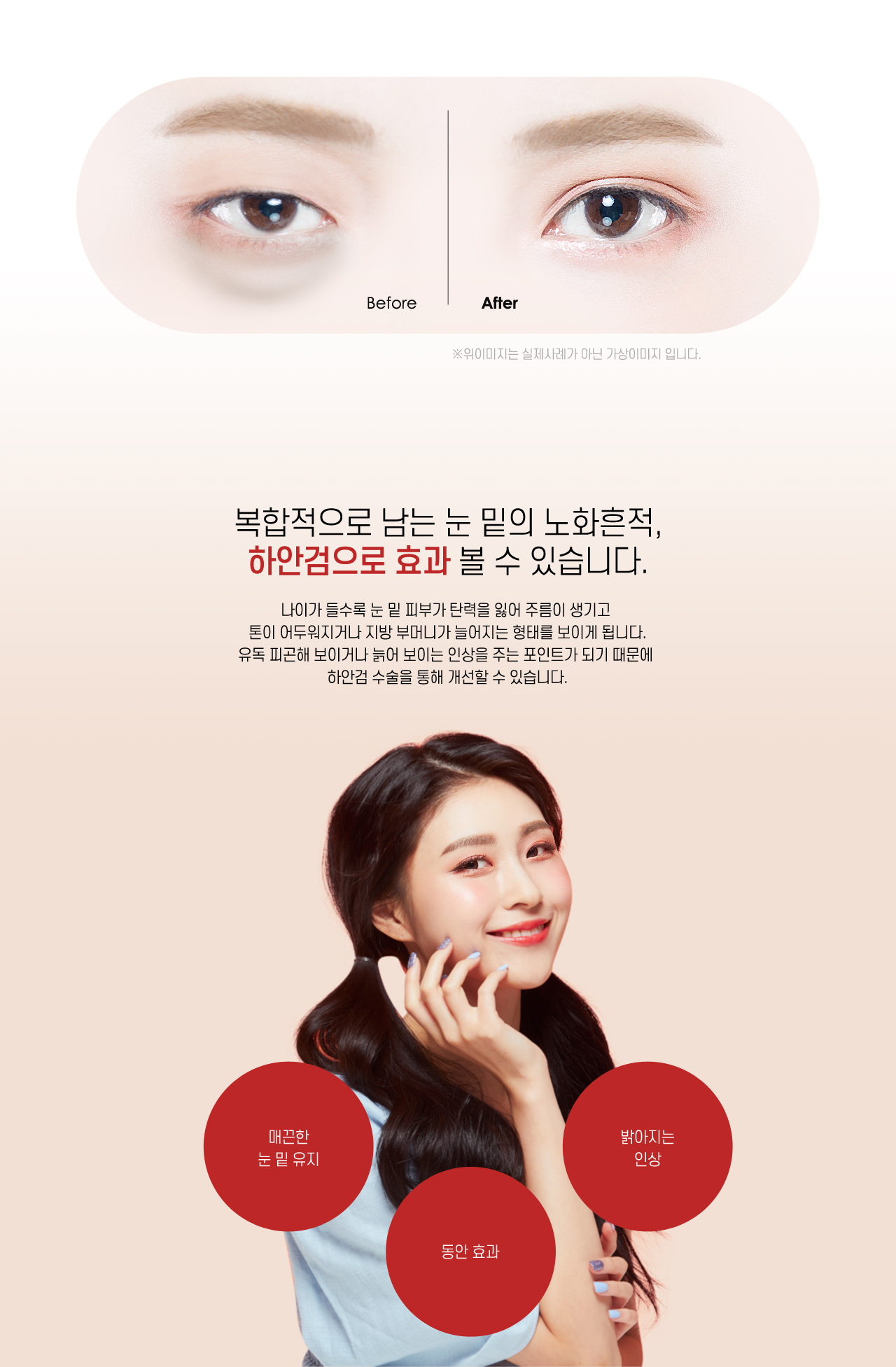 하안검이란?