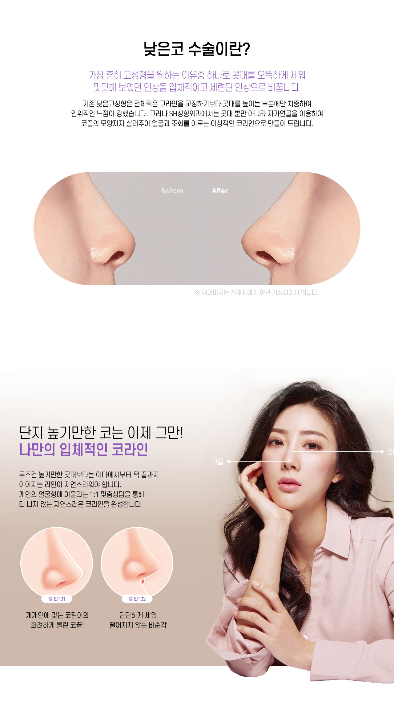 낮은코 수술이란?