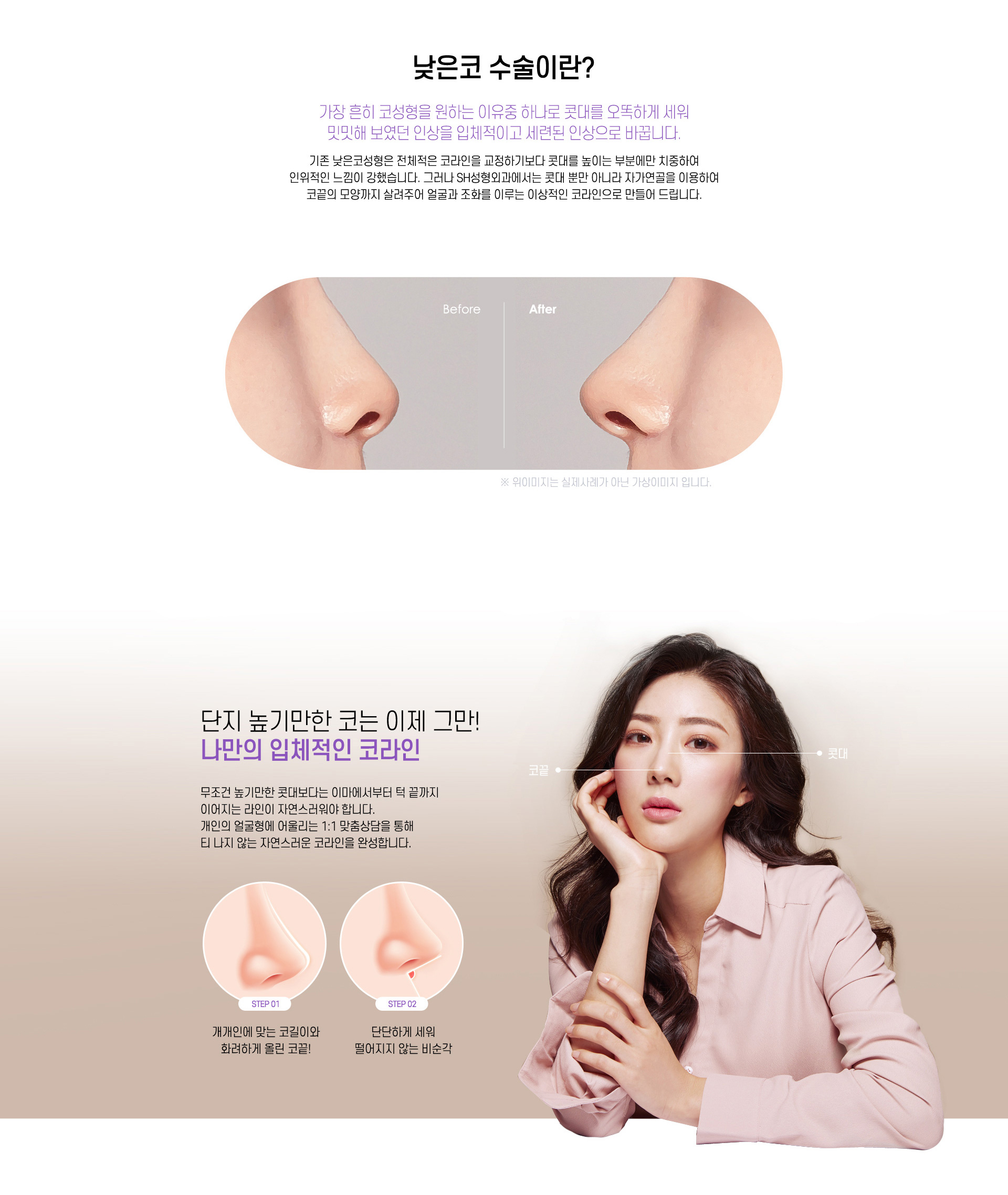 낮은코 수술이란?