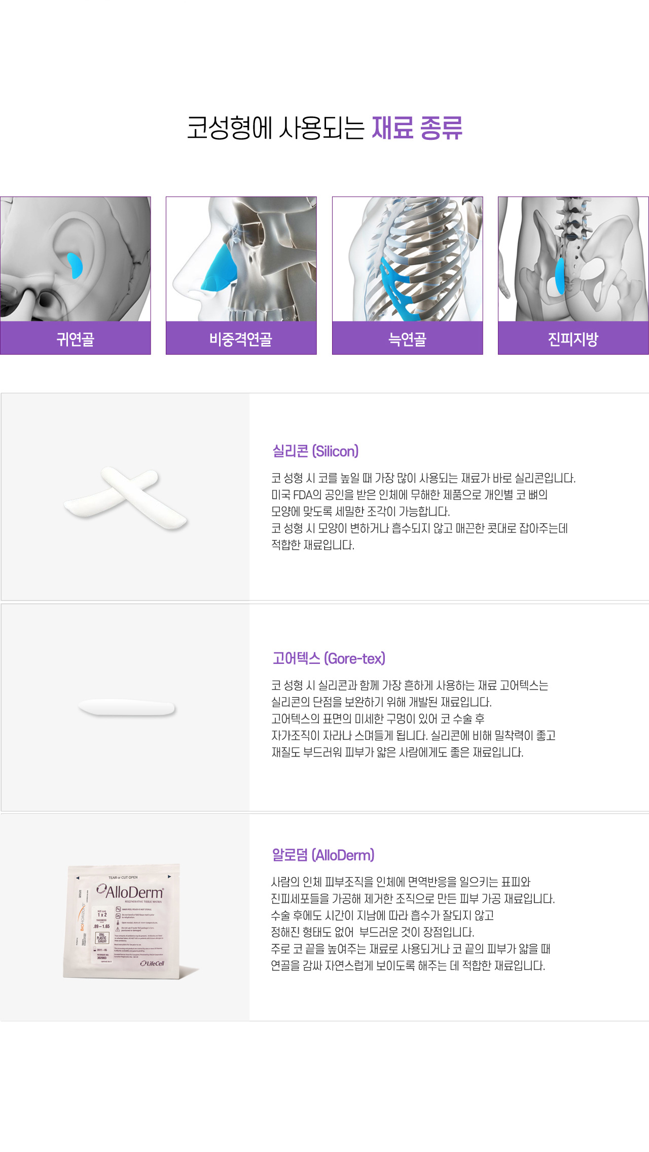 코성형에 사용되는 재료 종류