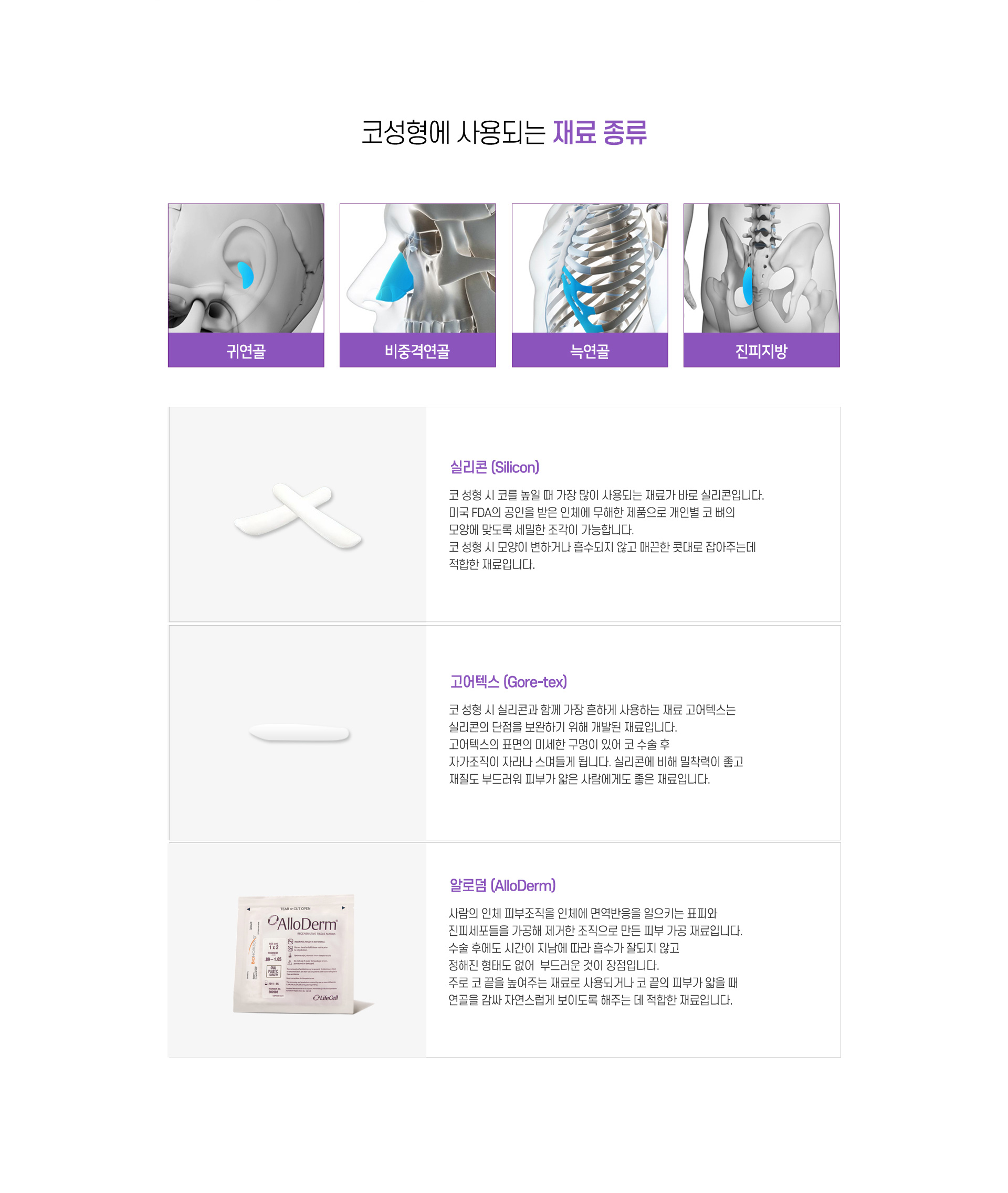 코성형에 사용되는 재료 종류