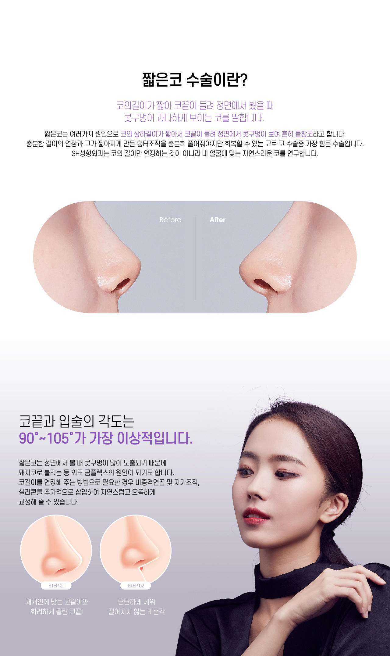 짧은코 수술이란?