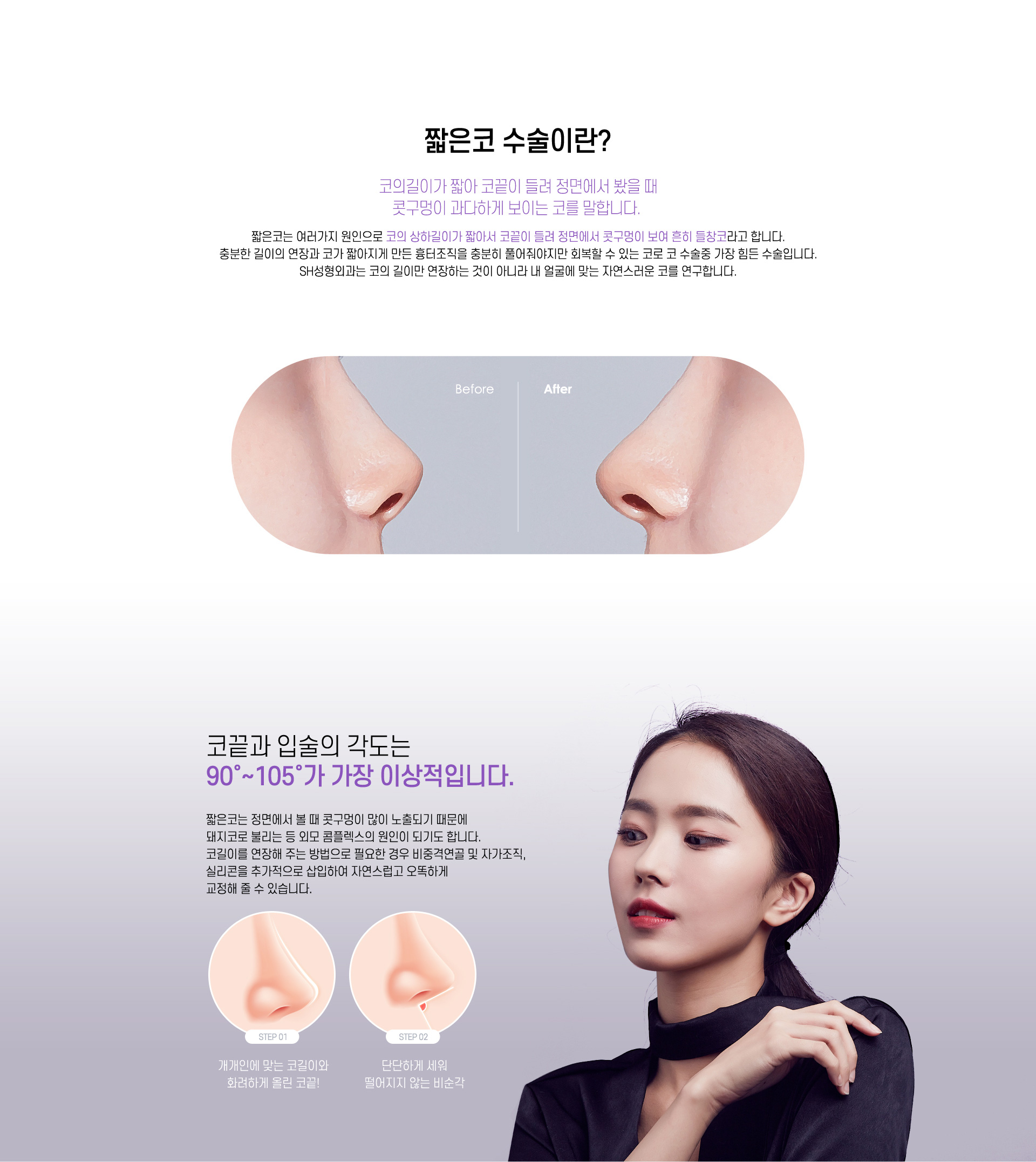짧은코 수술이란?