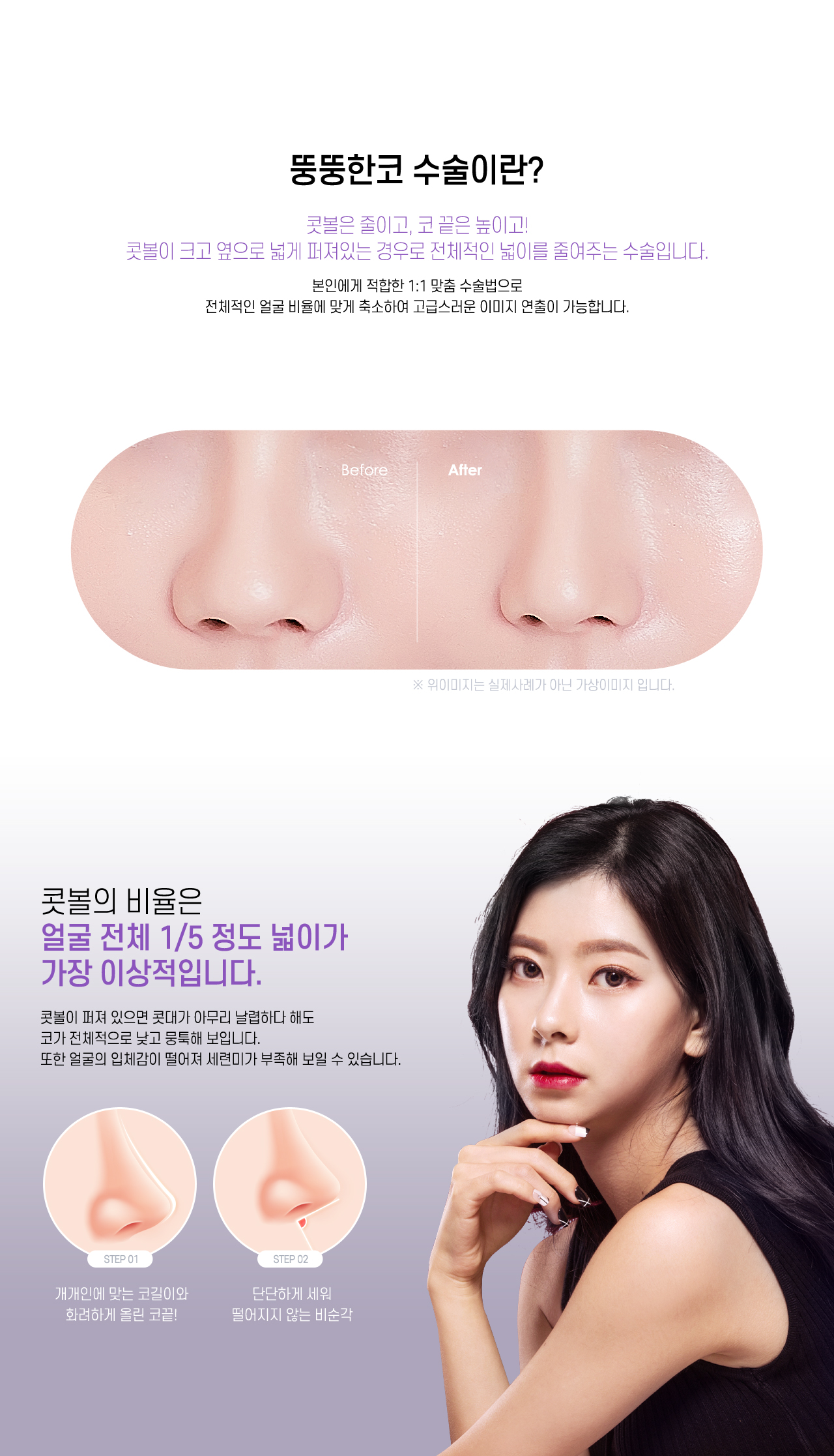뚱뚱한코 수술이란?