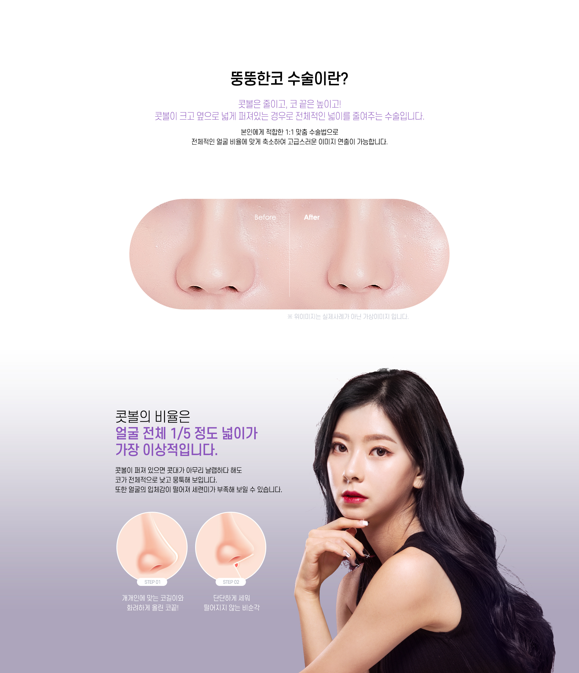 뚱뚱한코 수술이란?
