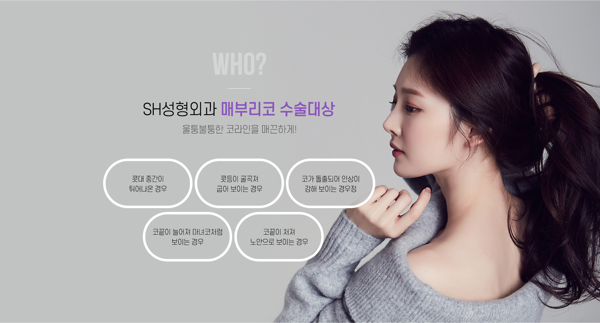 매부리코 수술대상