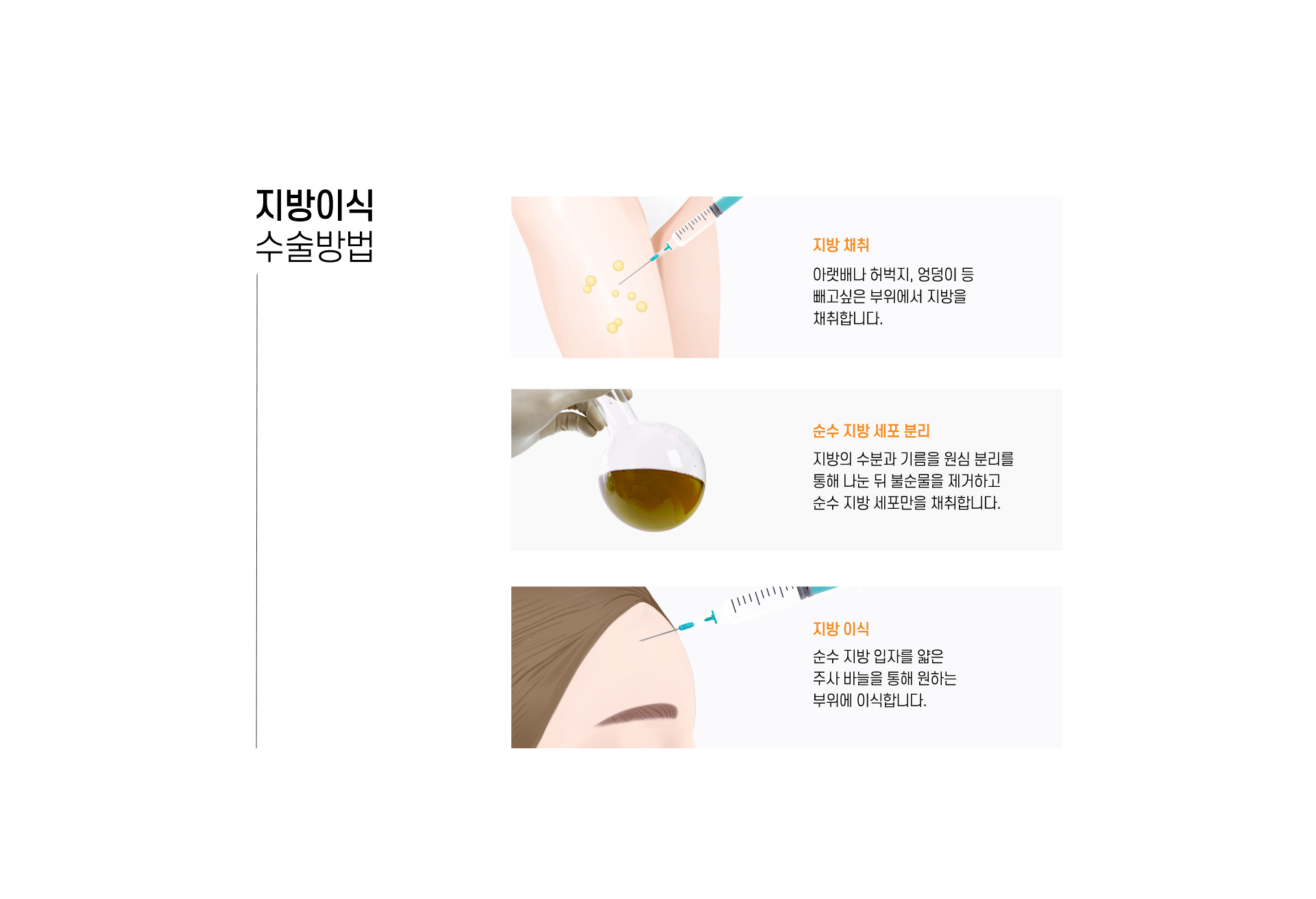 지방이식 수술방법