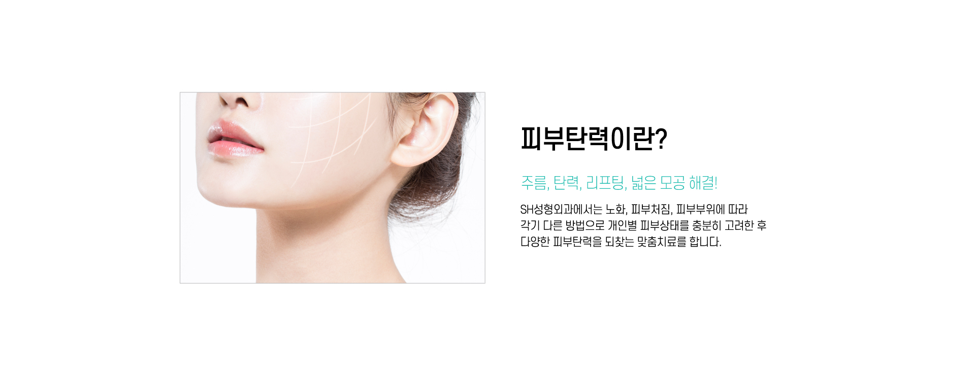 피부탄력 이란?