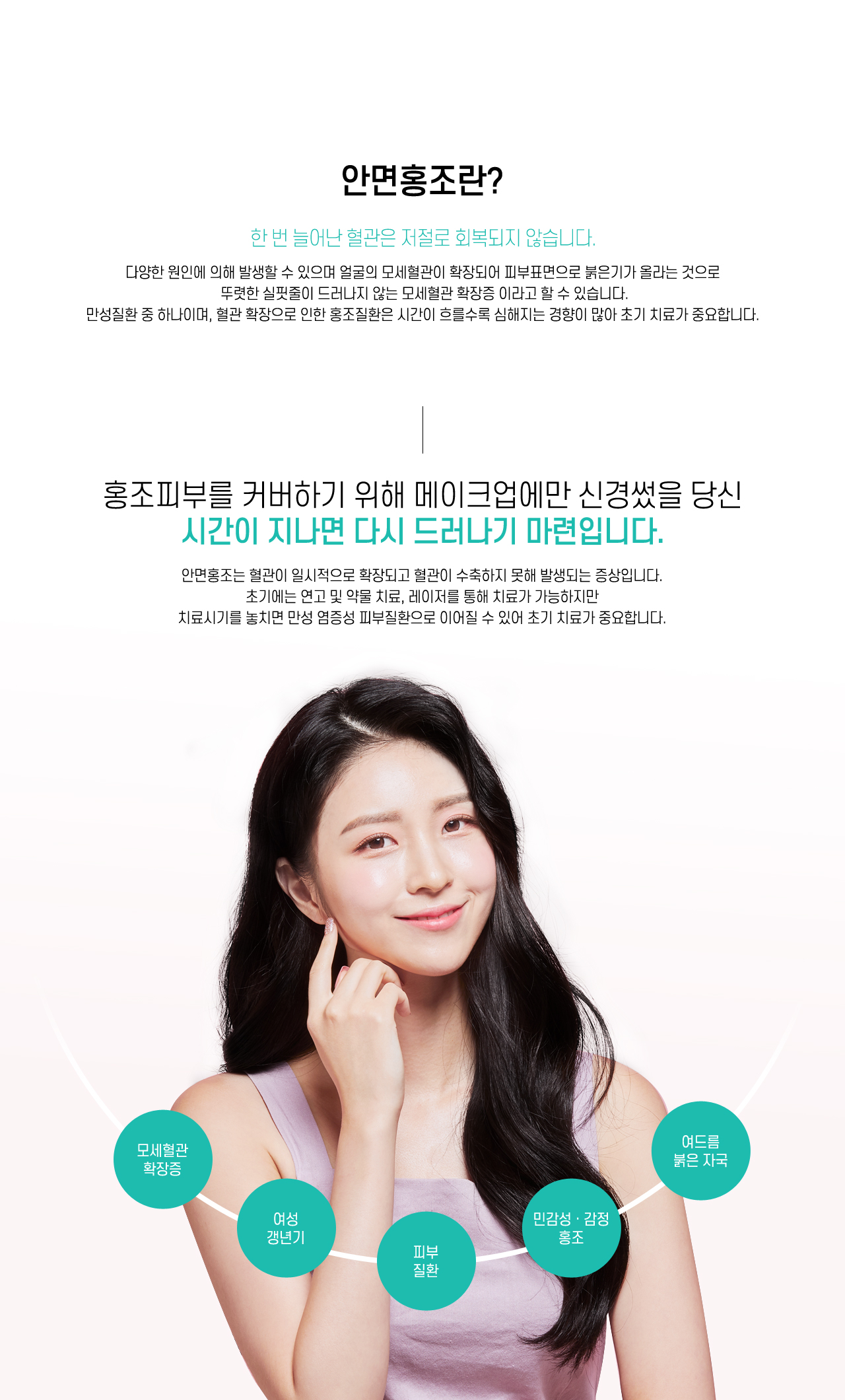 안면홍조란?