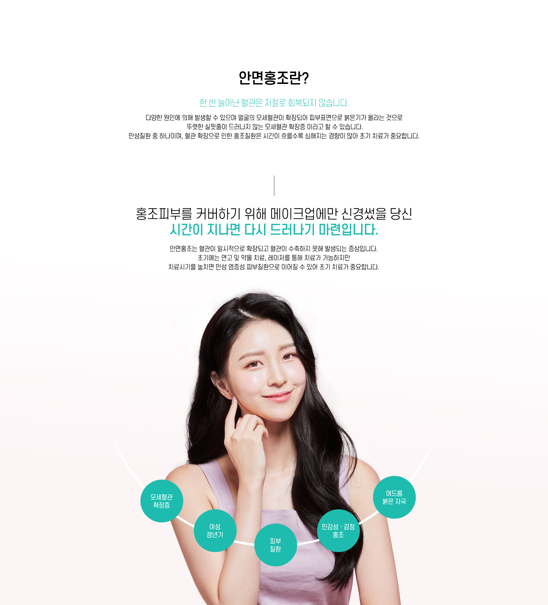 안면홍조란?