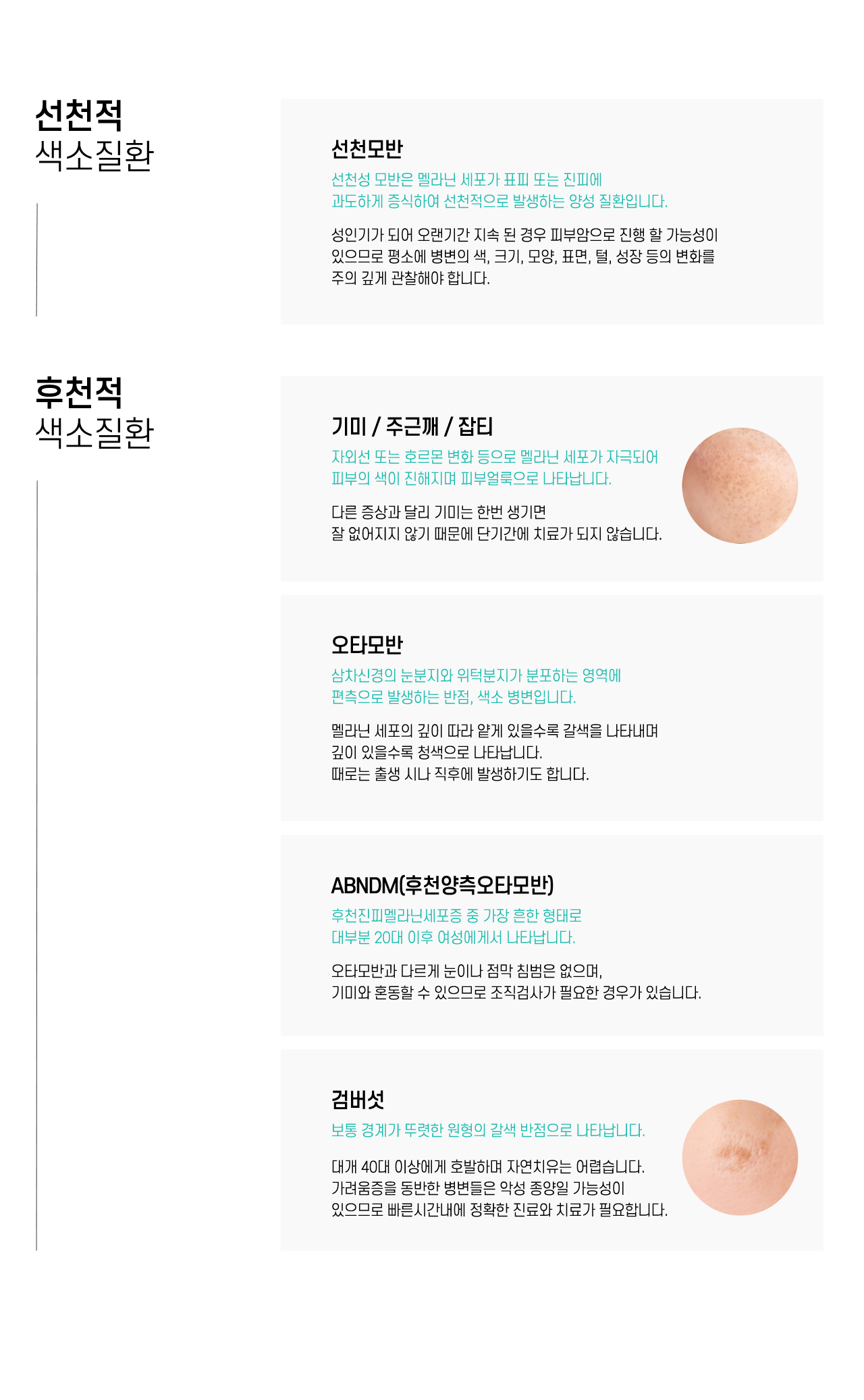 선천적/후천적 색소질환