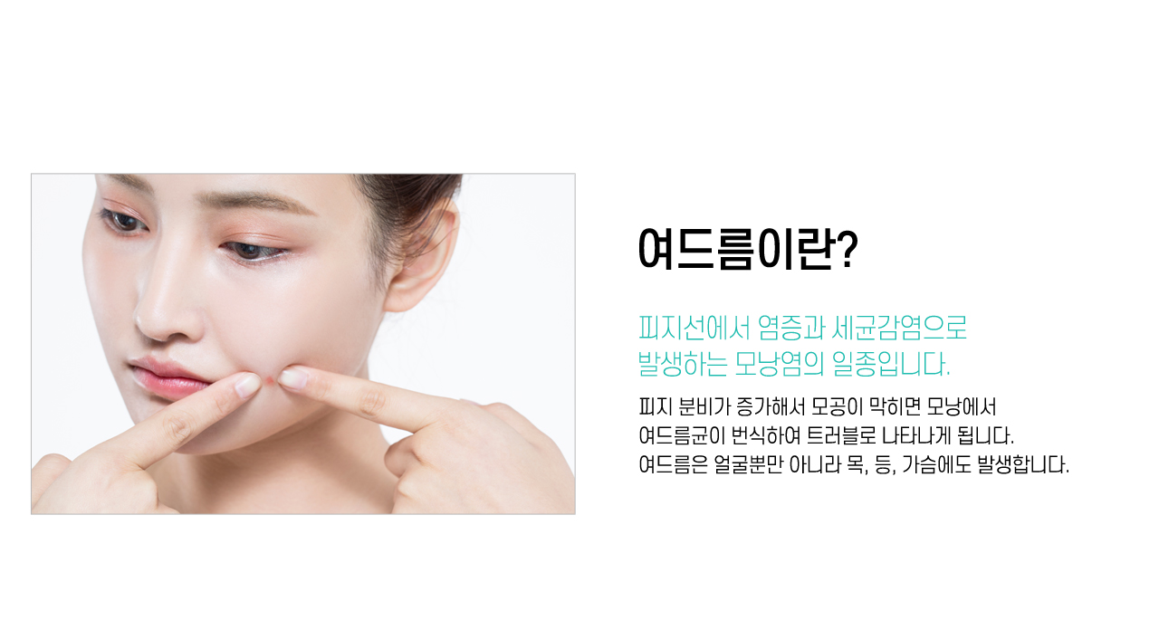 여드름이란?