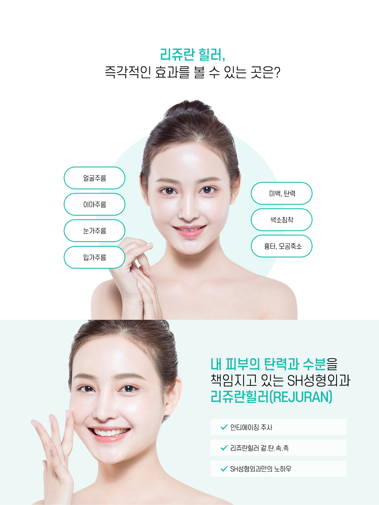 리쥬란힐러 부위