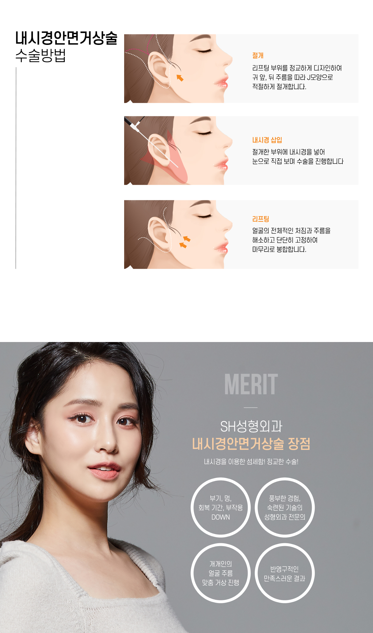 내시경안면거상술 수술방법