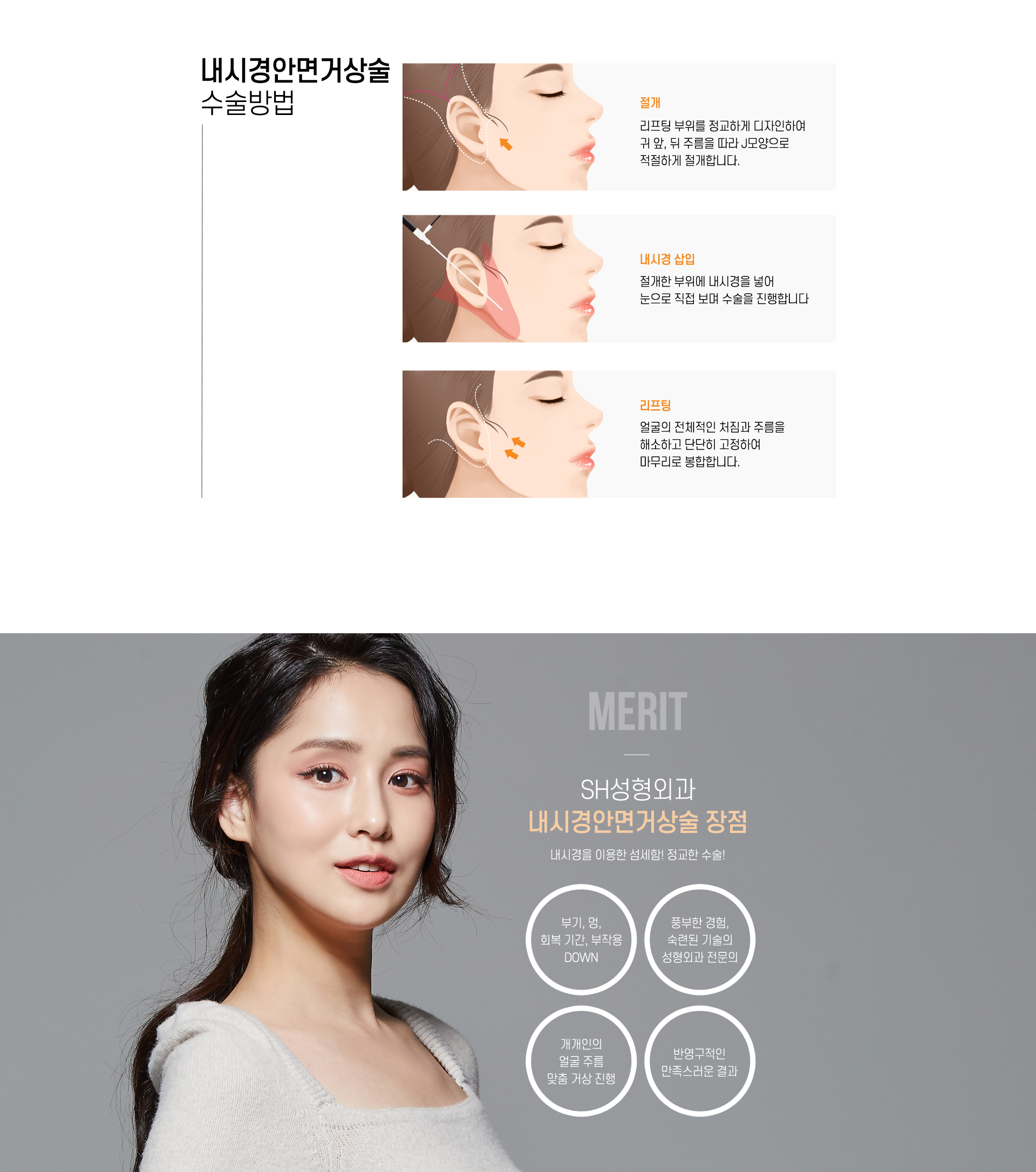 내시경안면거상술 수술방법