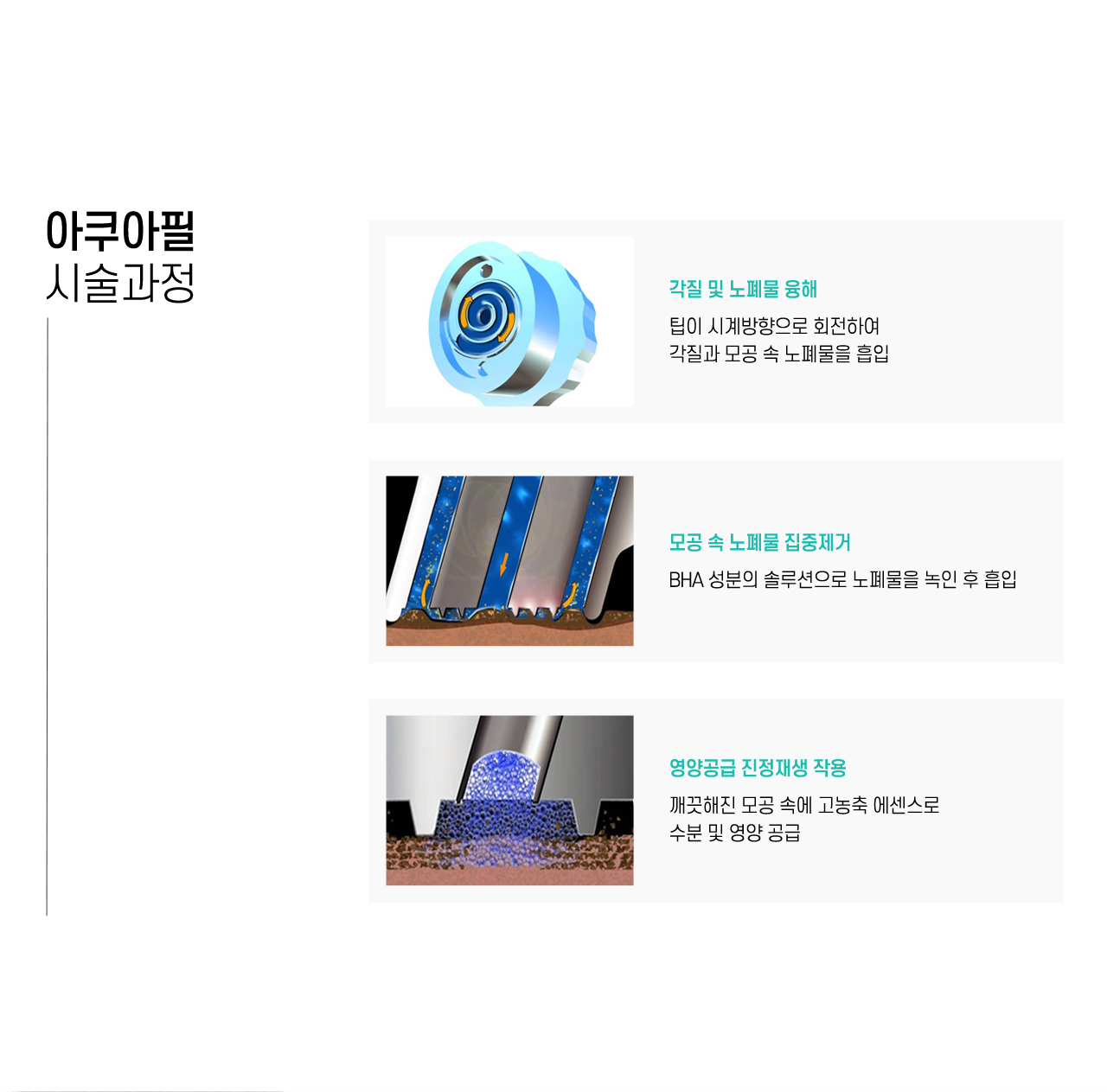 아쿠아필 시술과정