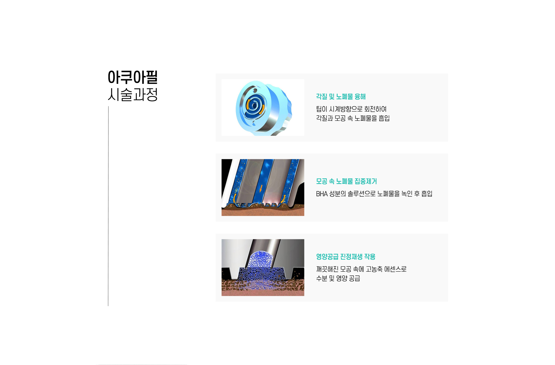 아쿠아필 시술과정