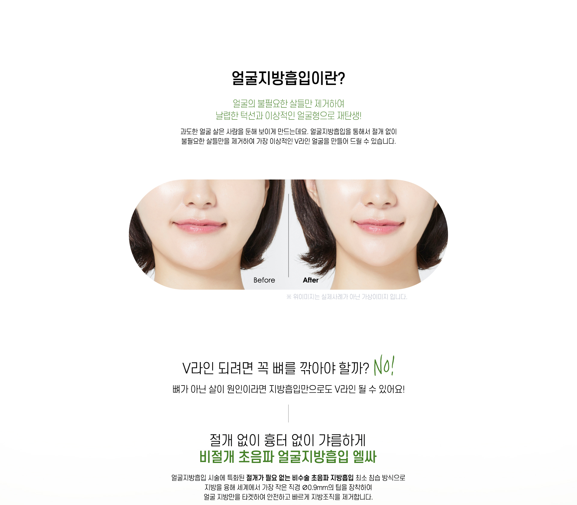 얼굴지방흡입이란?