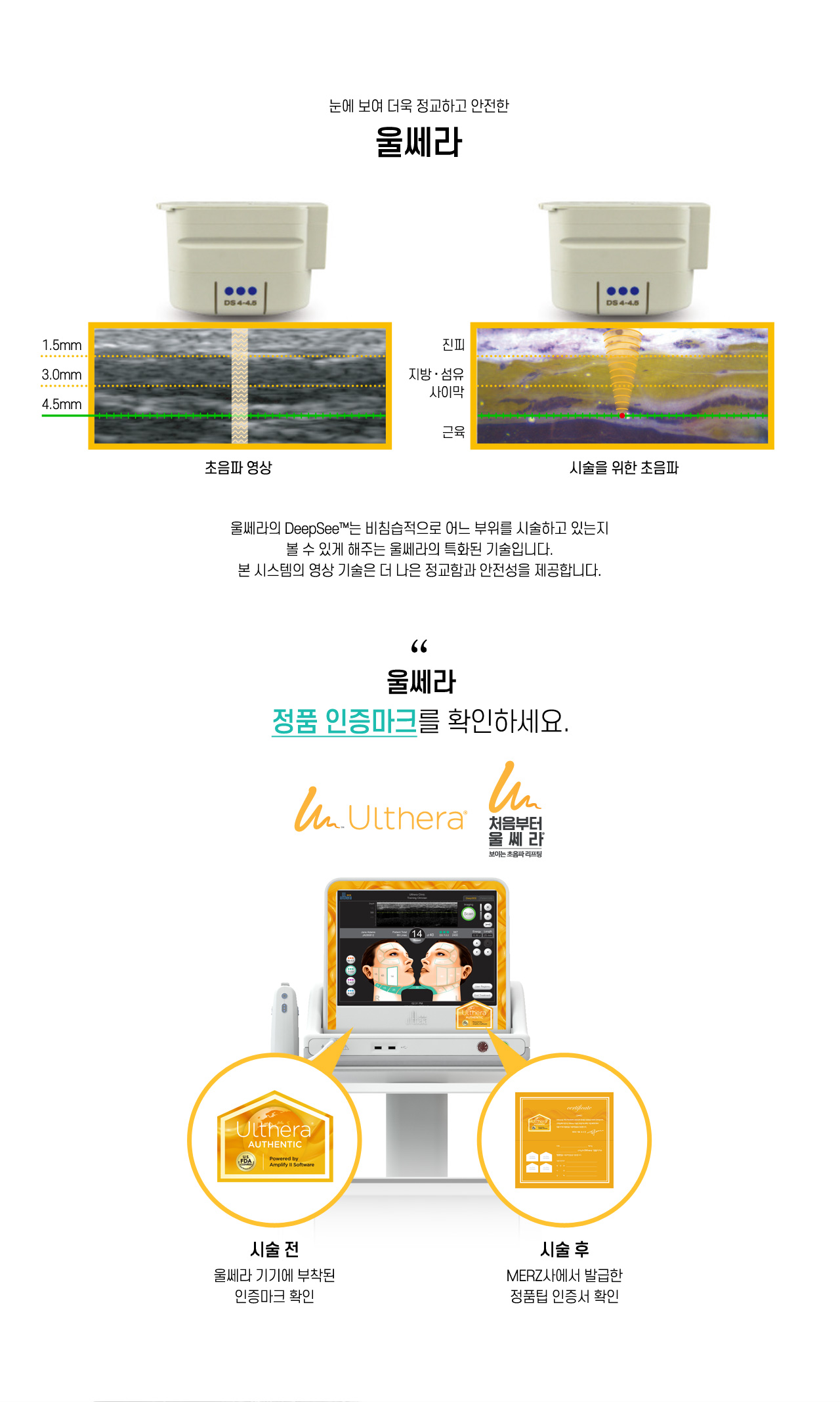 울쎄라 정품 인증마크를 확인하세요