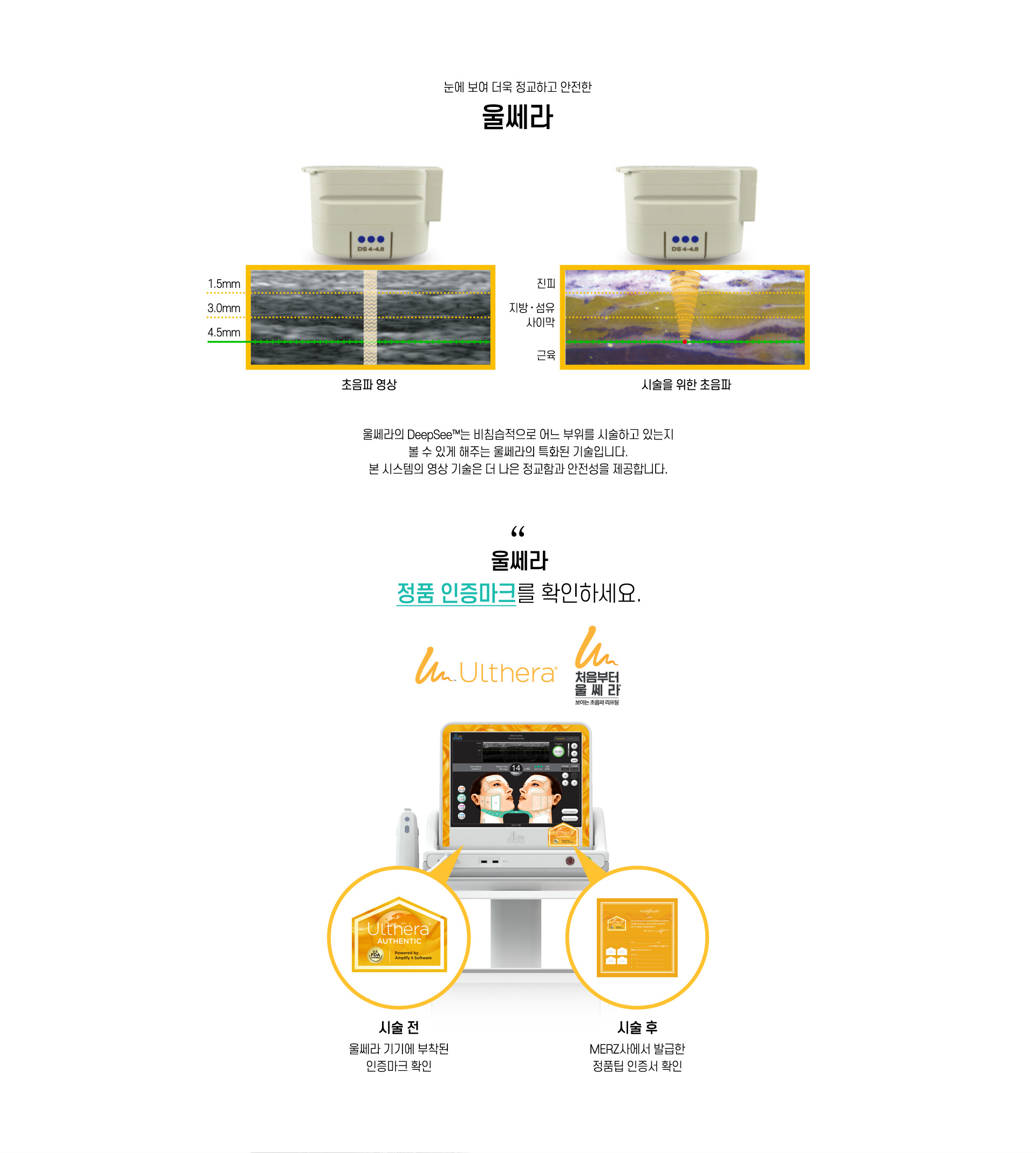 울쎄라 정품 인증마크를 확인하세요