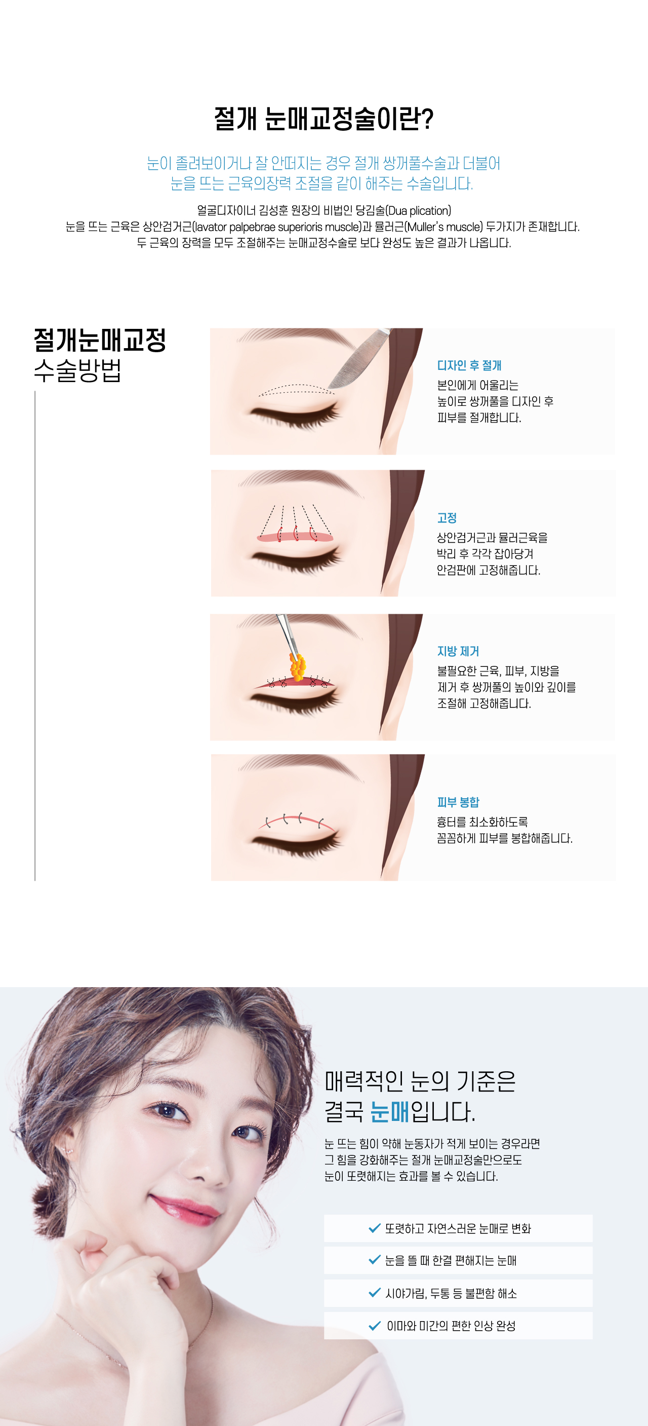 절개눈매교정