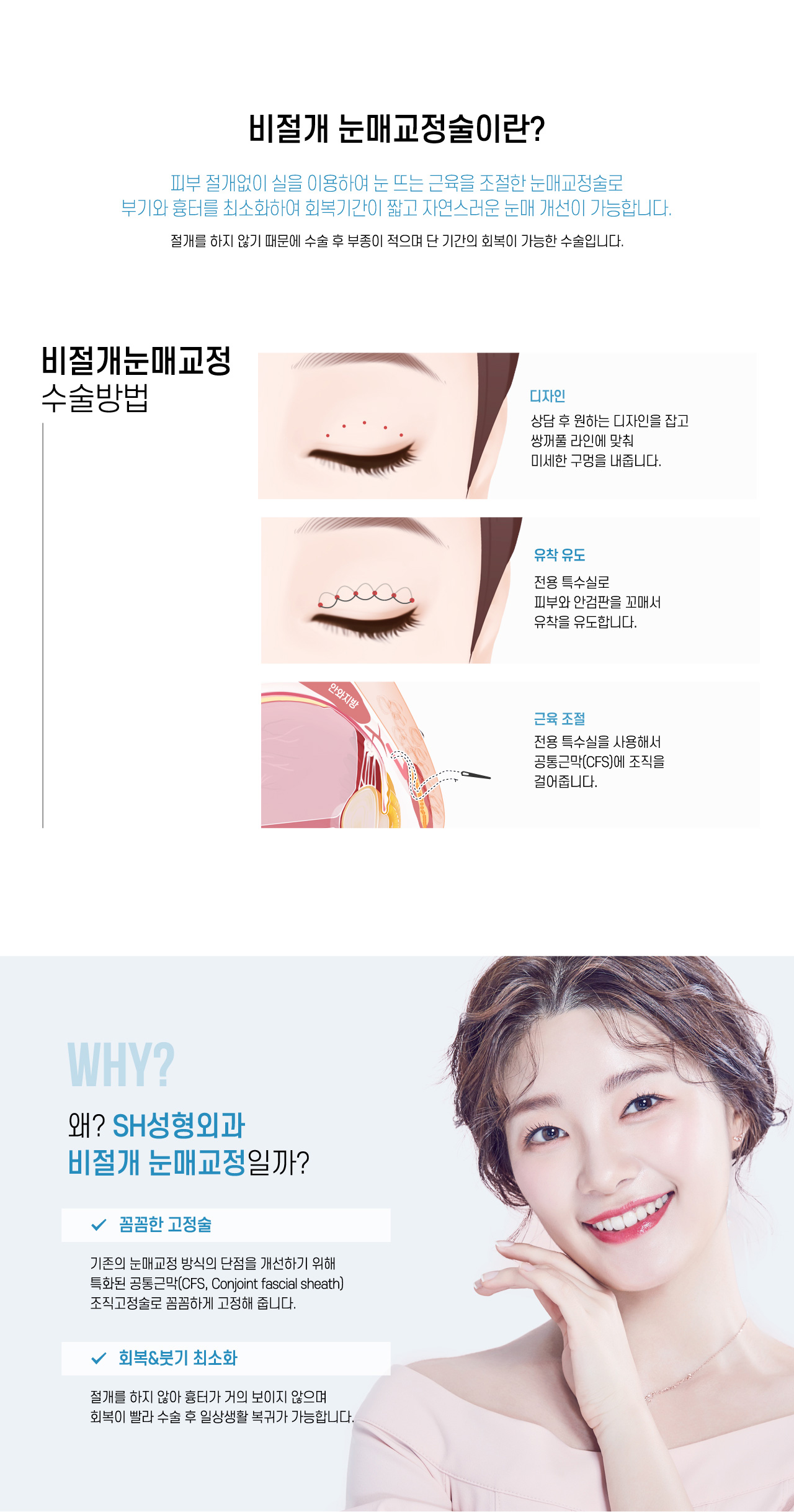 비절개눈매교정