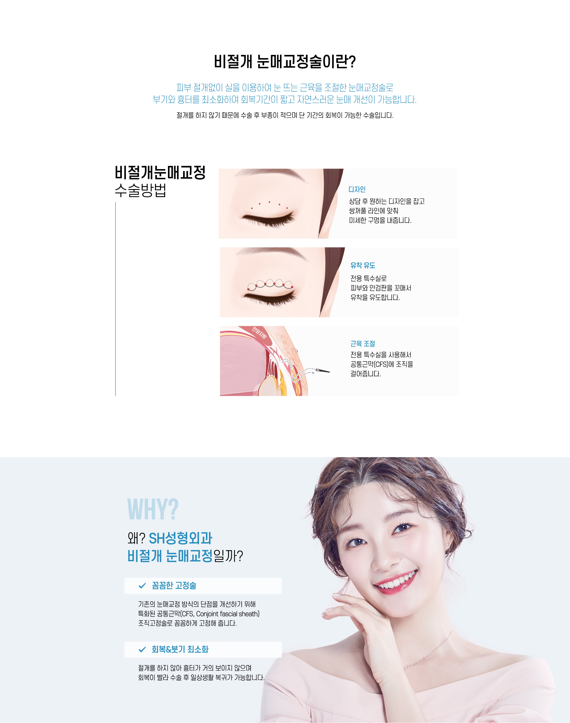 비절개눈매교정