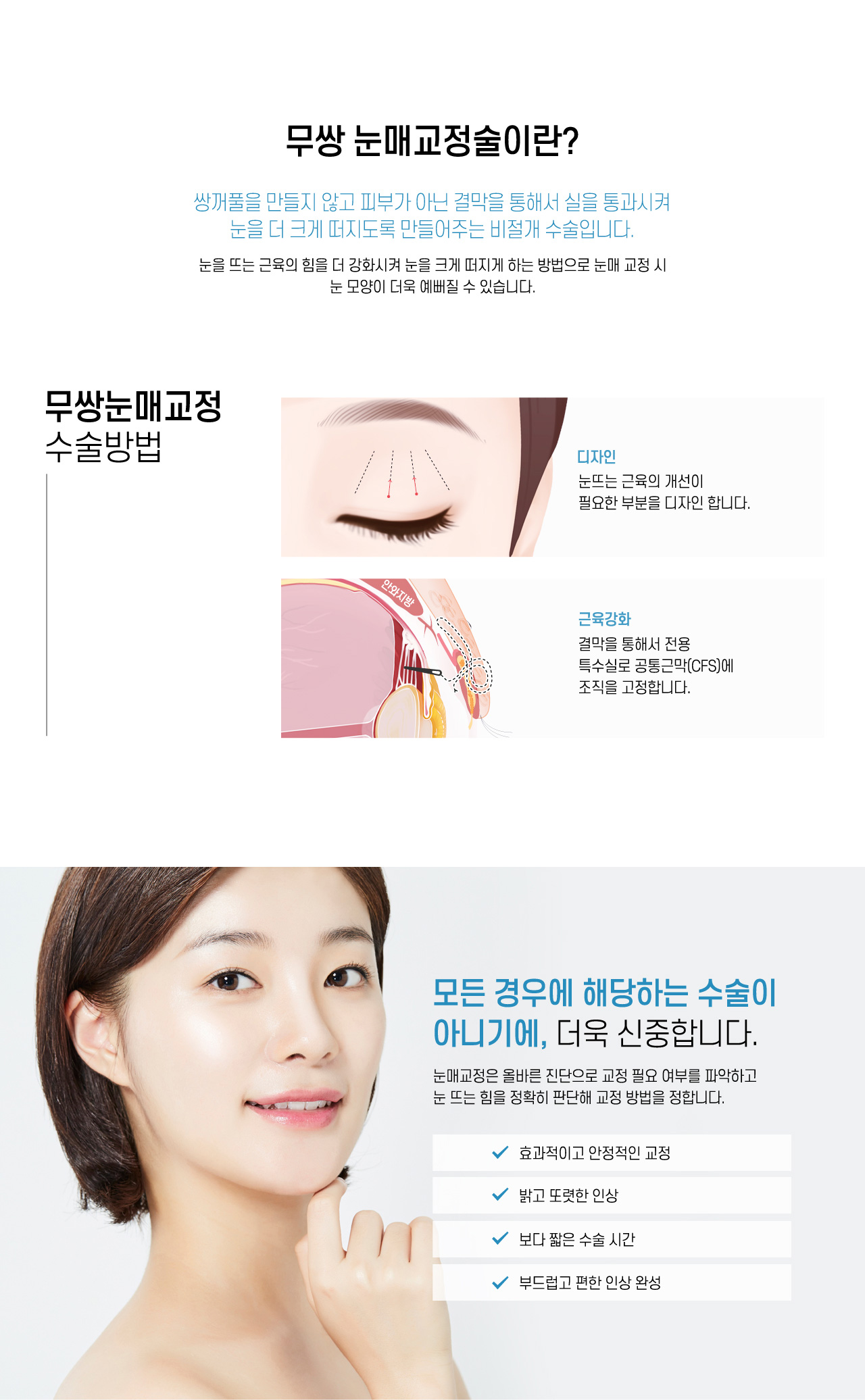 무쌍눈매교정