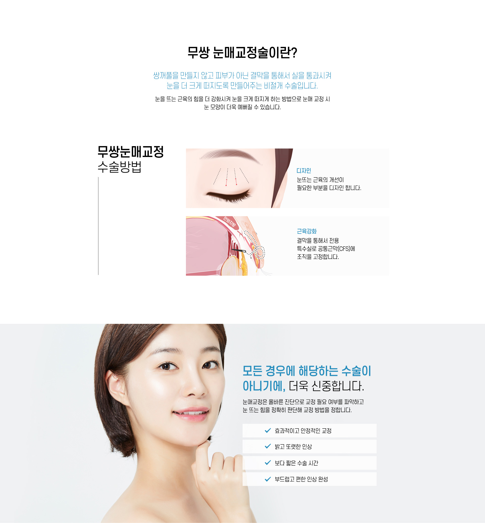 무쌍눈매교정