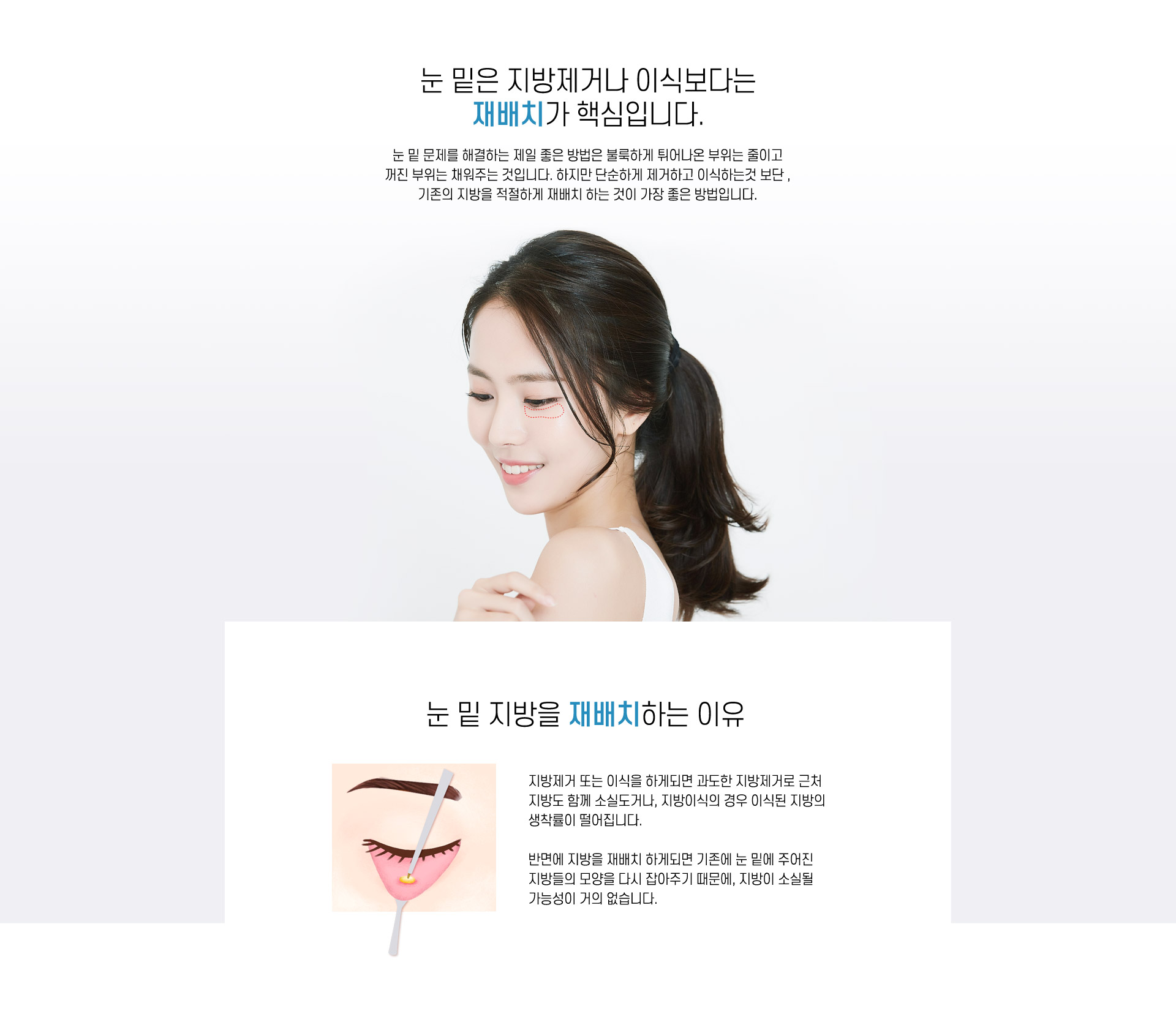 눈밑지방재배치가 답입니다