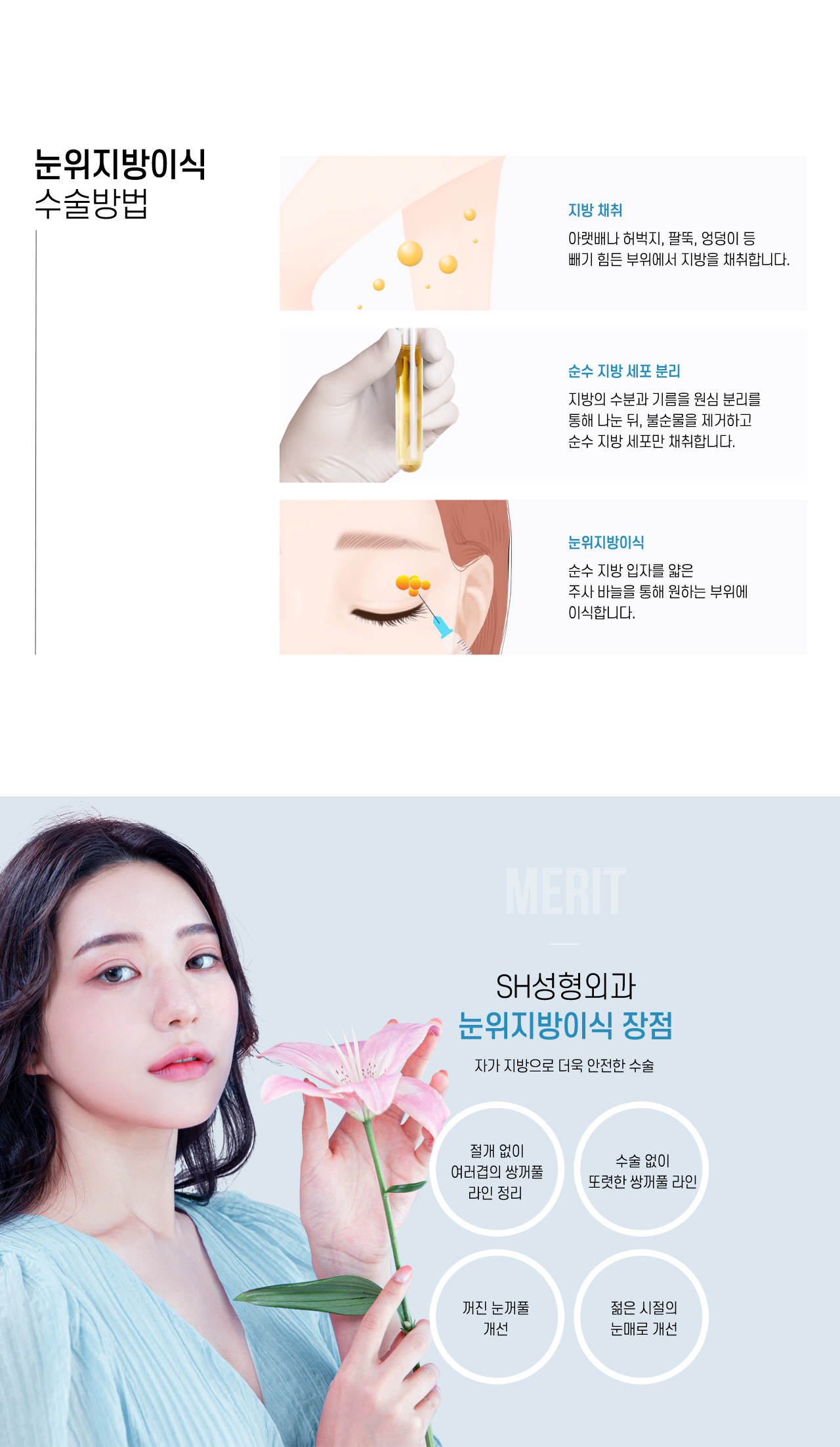 눈위지방이식 수술방법