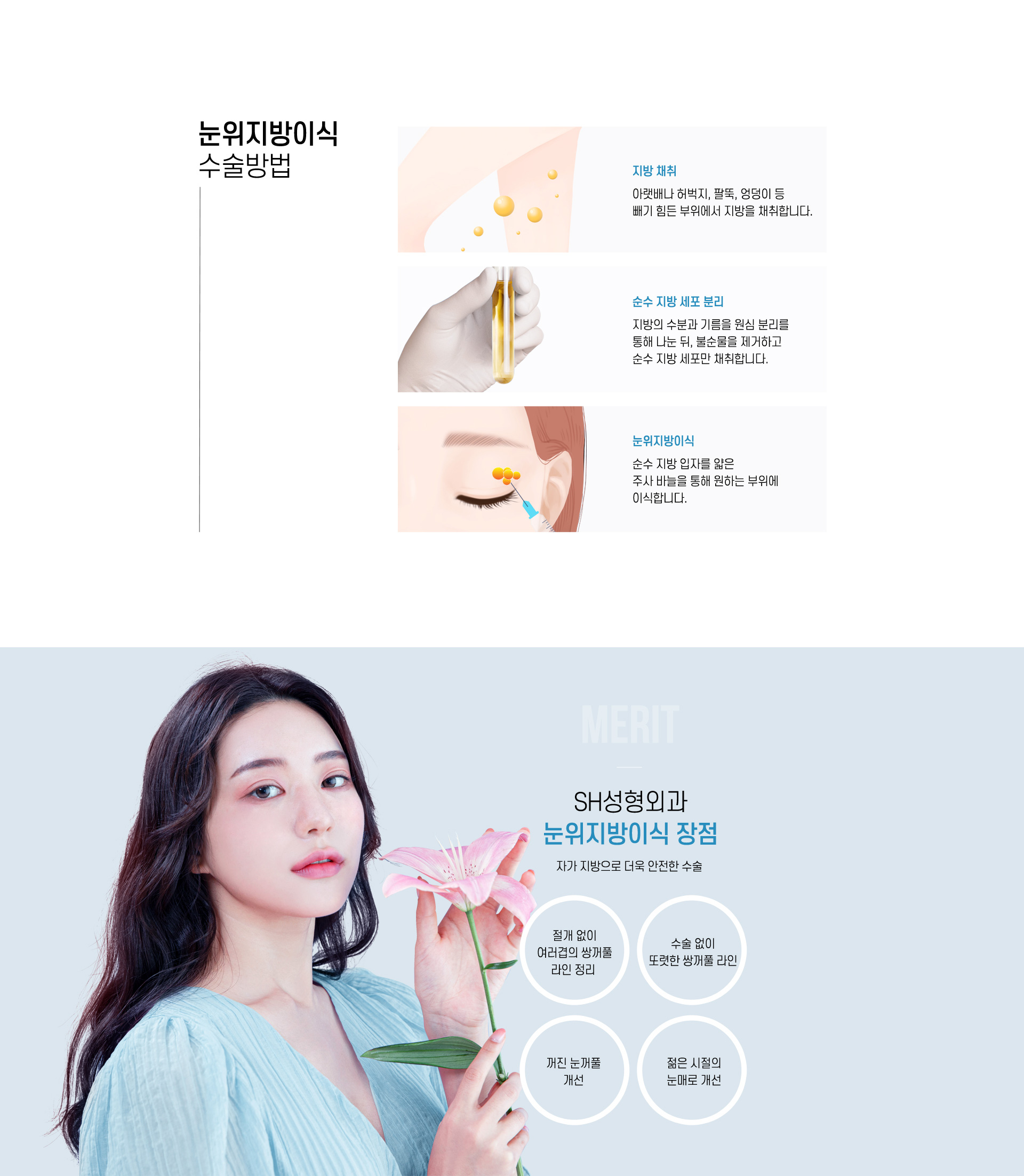 눈위지방이식 수술방법